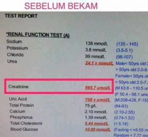 Benarkah Rawatan Bekam Itu Pseudosains? 1