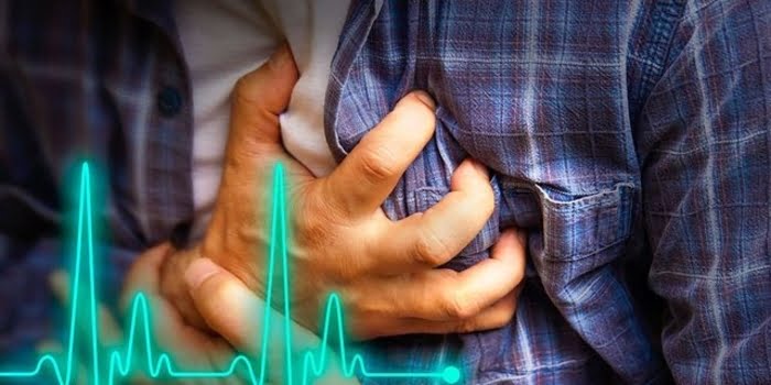 Memahami Cardiac Arrest: Pembunuh Senyap yang Perlu Anda Ketahui 1