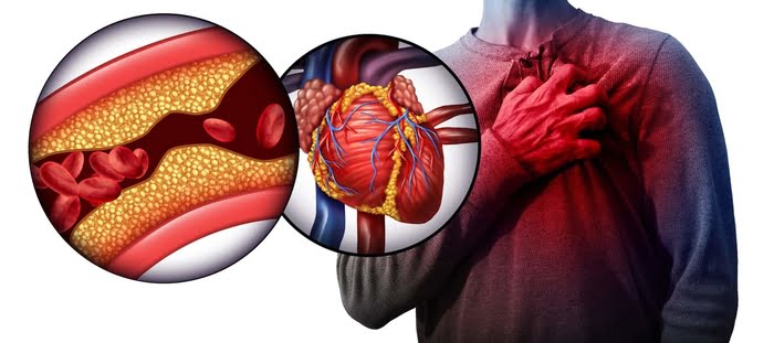 Memahami Hipertensi: Lebih Daripada Sekadar Angka Tekanan Darah 1