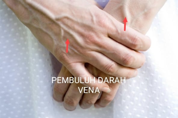 Perbezaan antara Pembuluh Darah Arteri dan Vena 1 Perbezaan antara Pembuluh Darah Arteri dan Vena 1