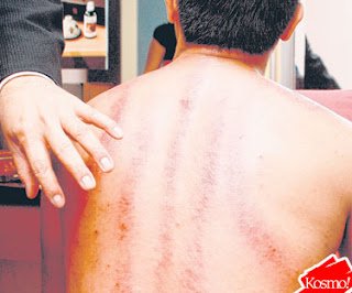 Rahsia Penyembuhan Purba: Terapi Guasha untuk Detoks & Kesihatan Holistik 2