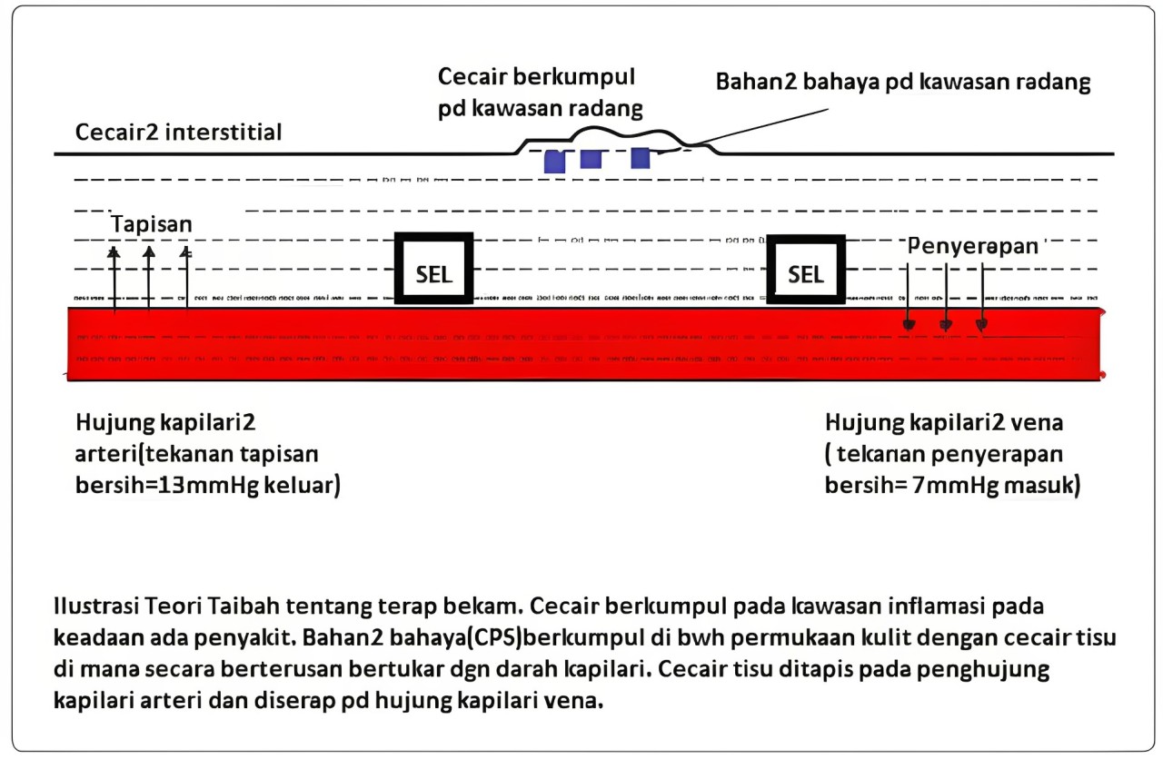 Teori Taibah dalam Terapi Bekam Darah 2