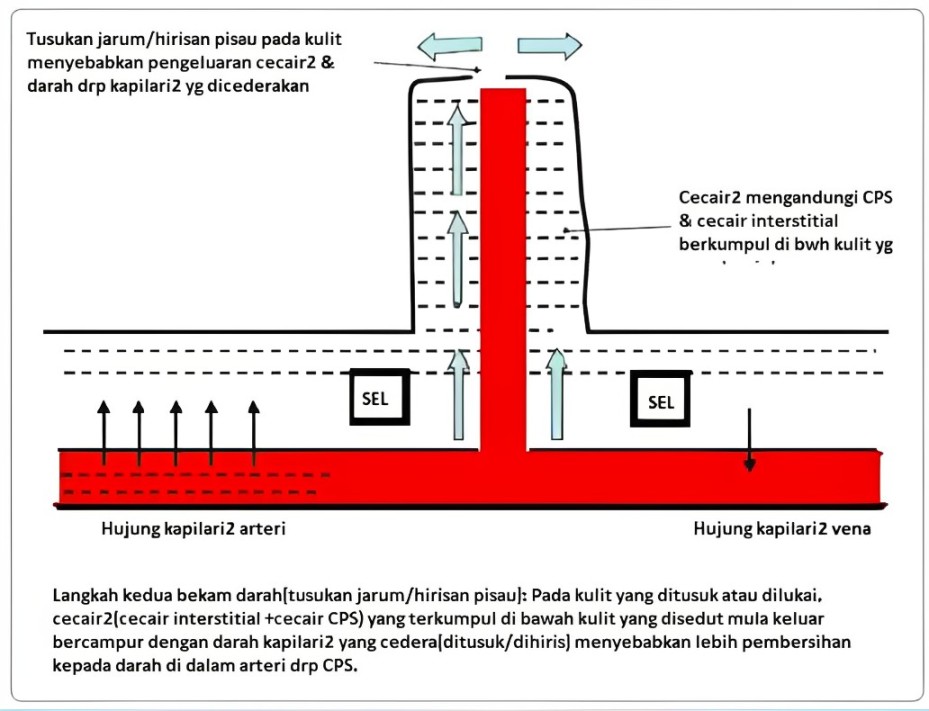Teori Taibah dalam Terapi Bekam Darah 4