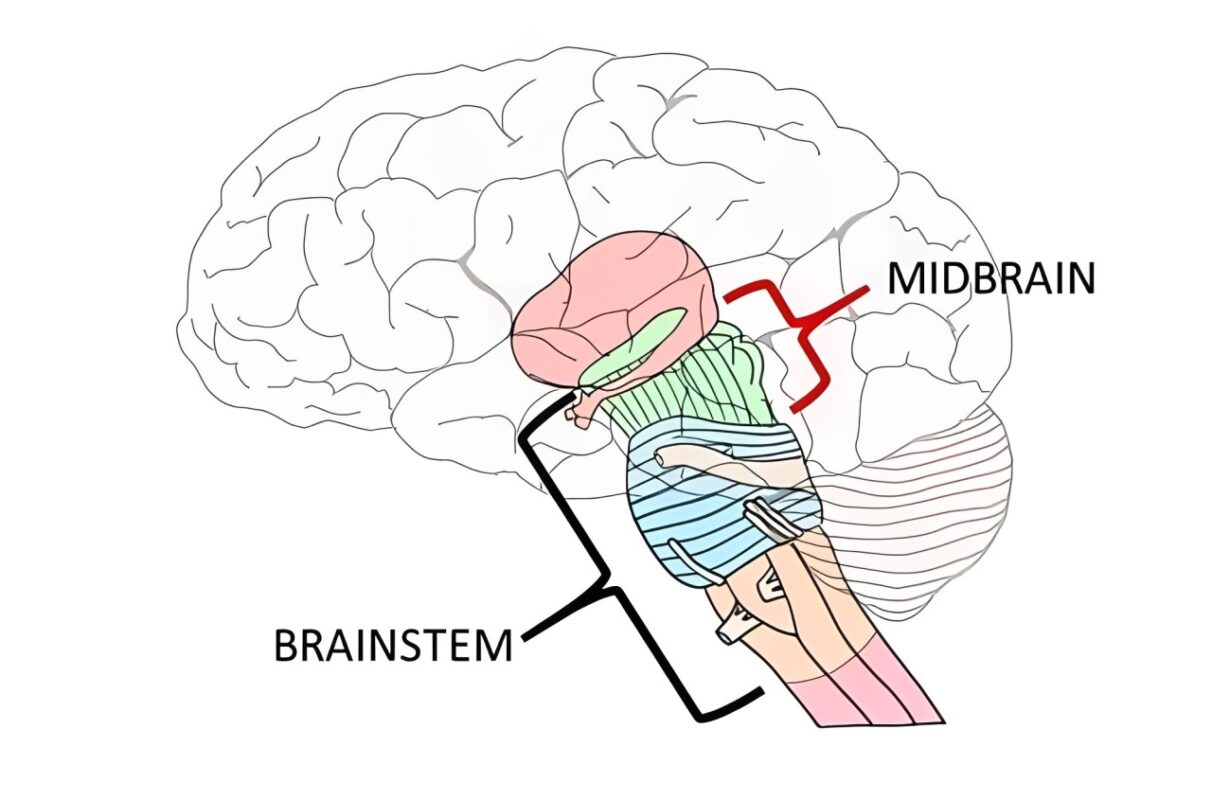 Keunikkan Otak Tengah (Mid Brain) 1 Keunikkan Otak Tengah (Mid Brain) 1
