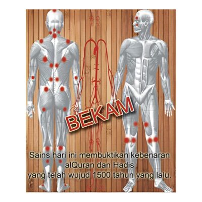 Terapi Bekam: Kaedah Tradisional dengan Manfaat Moden untuk Kesihatan 1