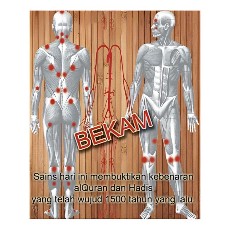 Terapi Bekam: Kaedah Tradisional dengan Manfaat Moden untuk Kesihatan 1