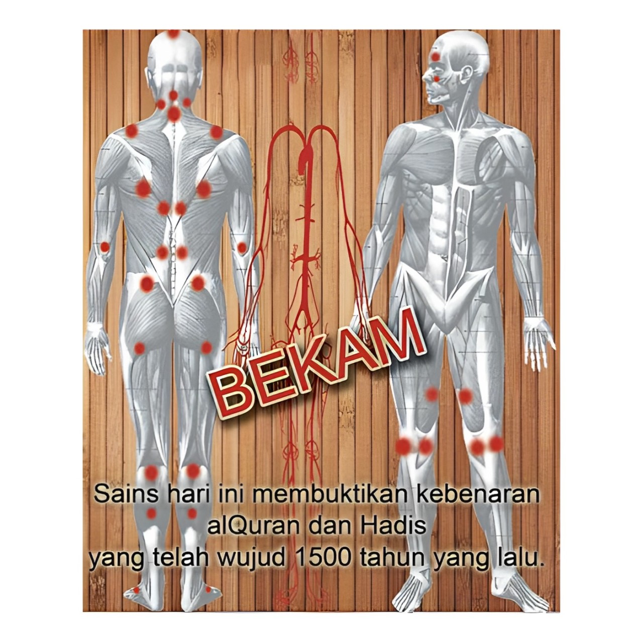 Terapi Bekam: Kaedah Tradisional dengan Manfaat Moden untuk Kesihatan 1