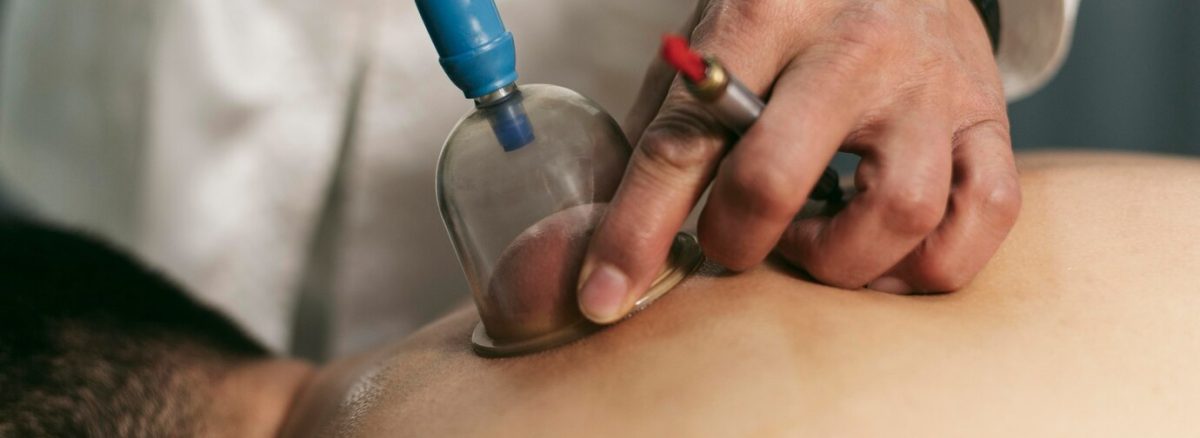 Stigma Masyarakat Mengenai Rawatan Bekam: Mengapa Ia Perlu Dihapuskan? 1