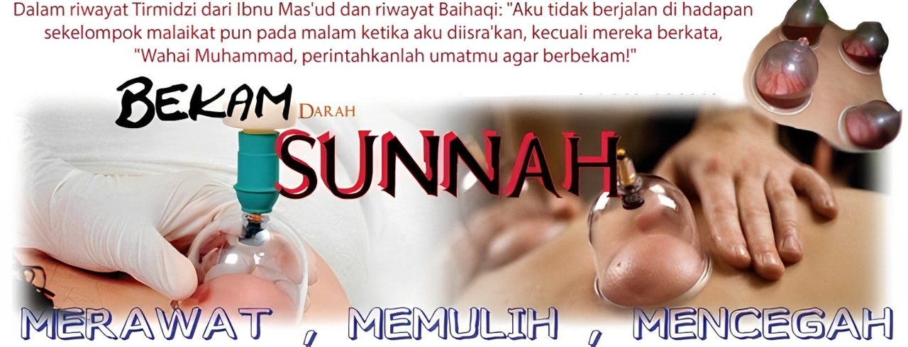 Servis Bekam At Taibah 1