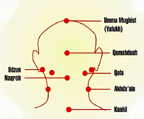 Bekam Kepala: Terapi Tradisional yang Menarik Minat Dunia Moden 2